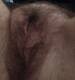 Vagina pelosa